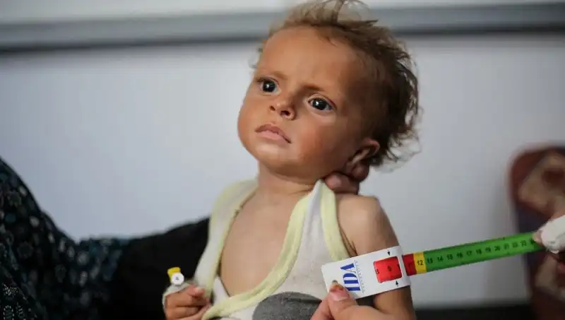İngiltere, 300 Gazzeli Çocuğa Yeni Bir Hayat Sunmaya Hazırlanıyor